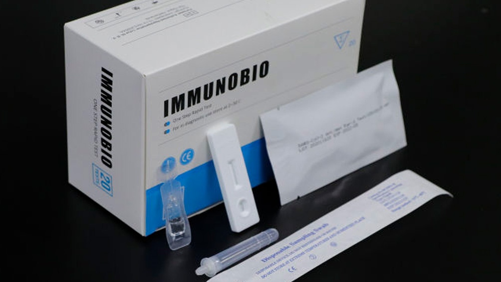 Se autorizó la venta en farmacias de un test rápido para detectar coronavirus