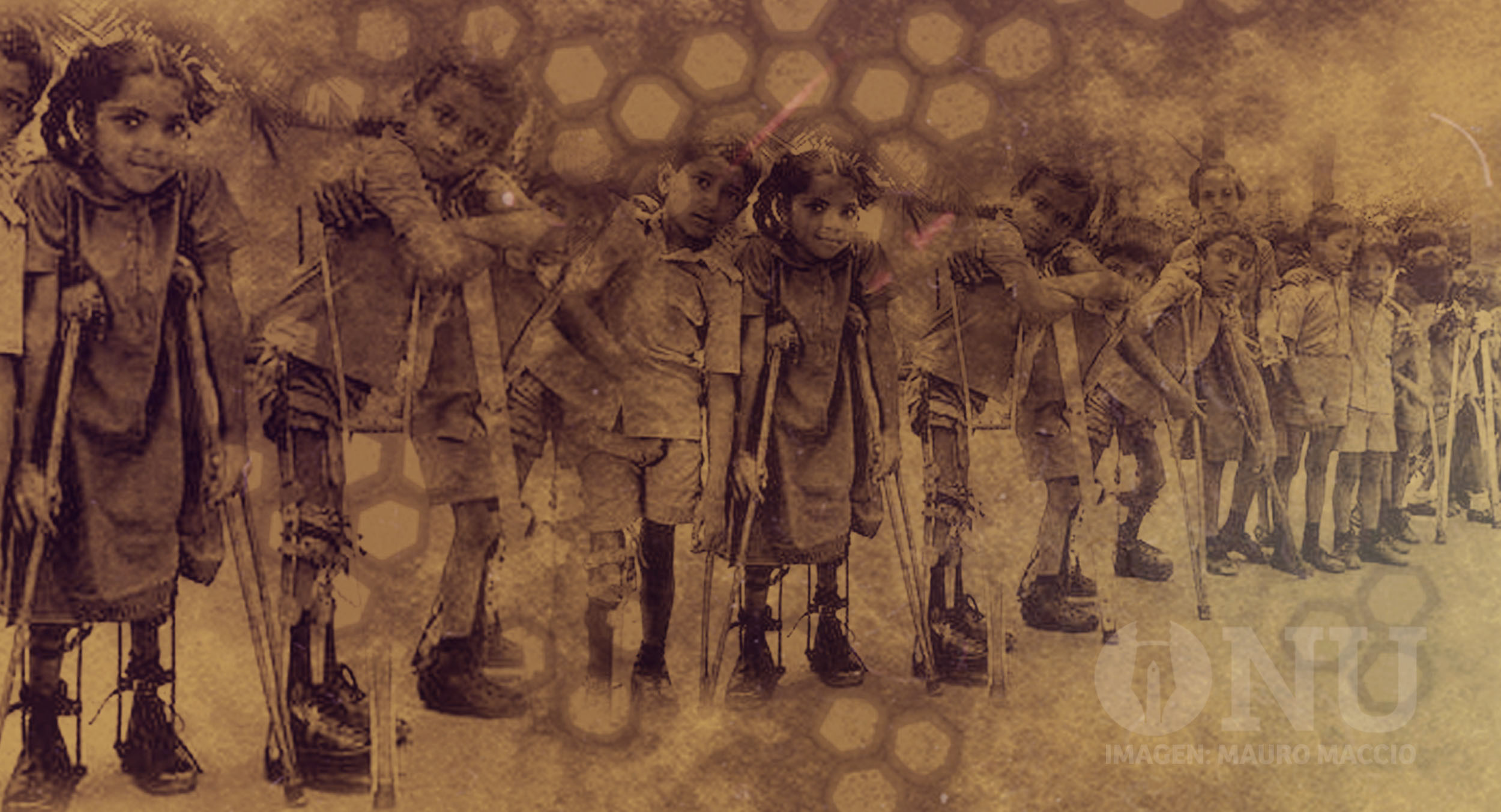 Cuando la vacuna contra la poliomielitis salvó al mundo