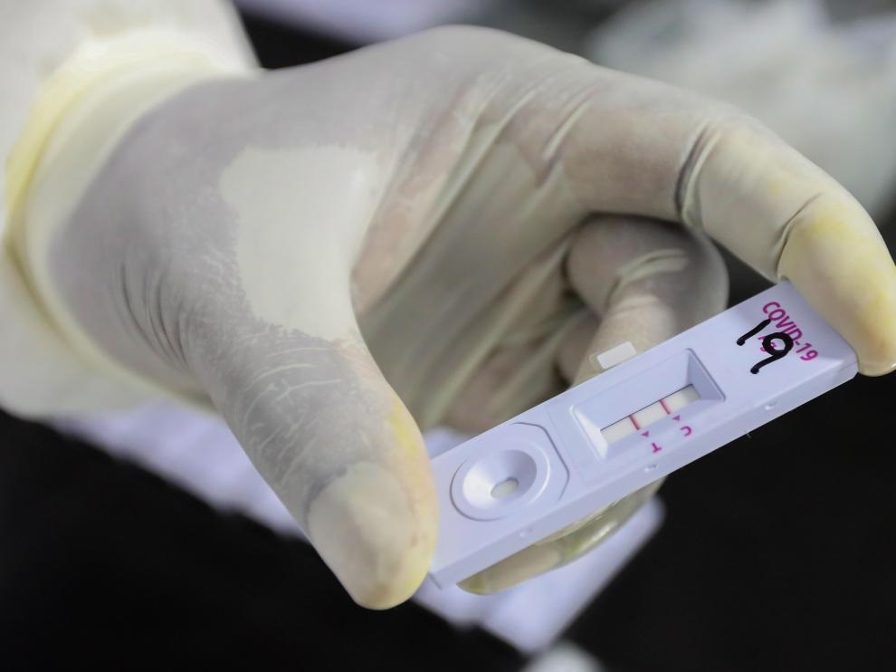 Quirós le pidió a Nación “liberar los autotest de coronavirus”