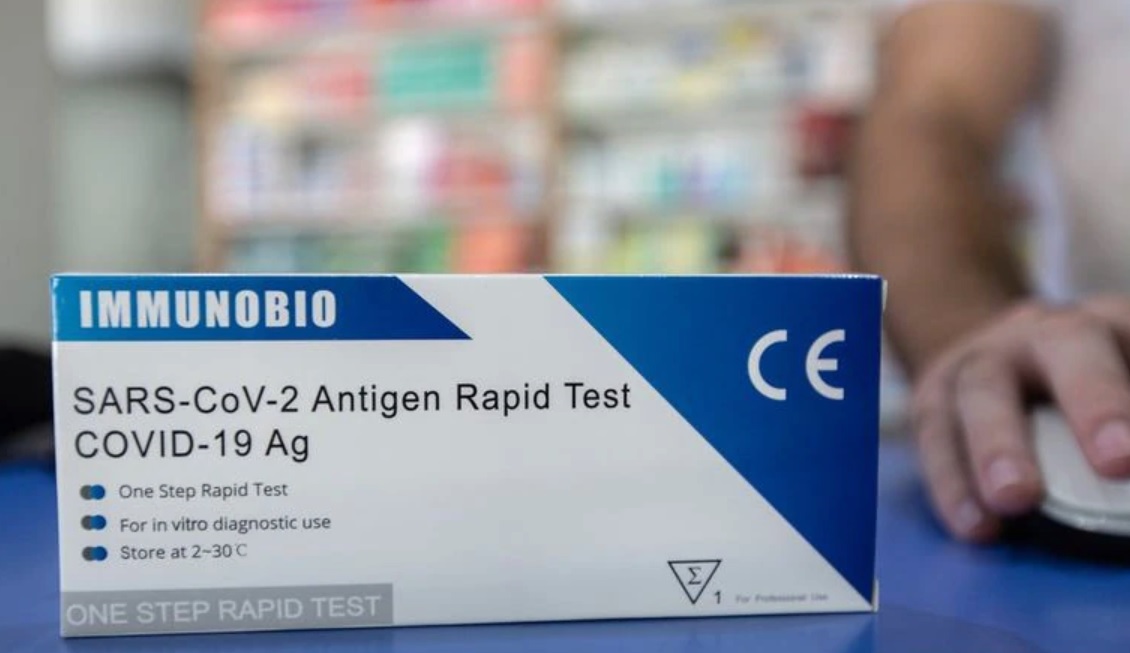 Autotest de Covid: el Gobierno estableció cómo informar el resultado