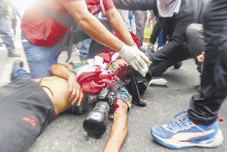 Represión en el Congreso: un fotógrafo lucha por su vida en el Ramos Mejía