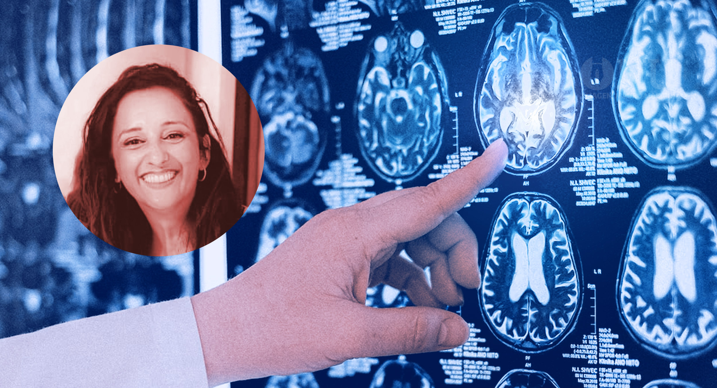 Fernanda Caparrós: “Es fundamental el diagnóstico temprano del Syngap1”